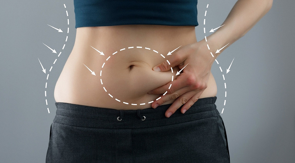 Abdominoplasty: 9 main facts that are important to know before surgery